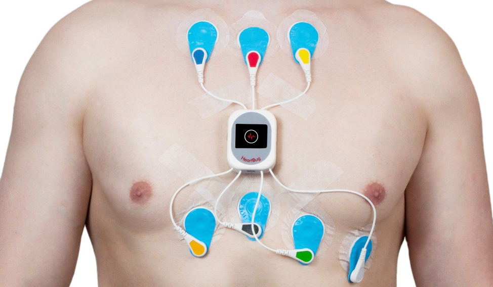 holter heart monitor