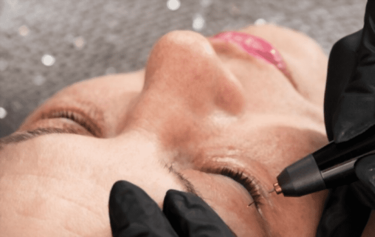 What Is a Plasma Pen and What Is It Used For?