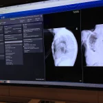 AI Radiology Software
