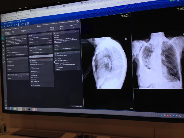 AI Radiology Software