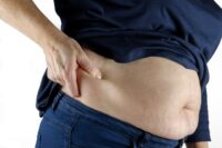 What are the alternatives to weight loss surgery?
